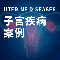 子宫内膜恶性肿瘤 9 