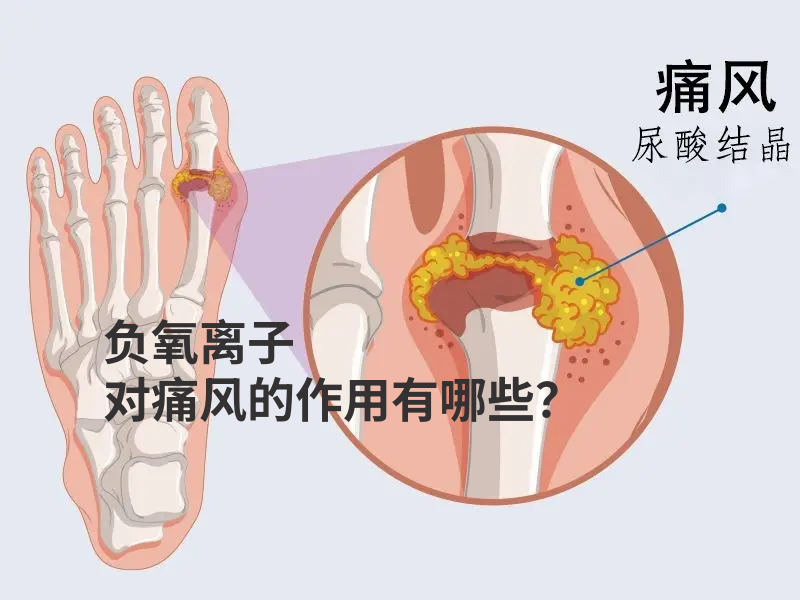 “ 负氧离子 ”针对 “ 痛风 ” 有没有作用呢？