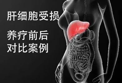 肝功能异常—养疗前后对比 4 