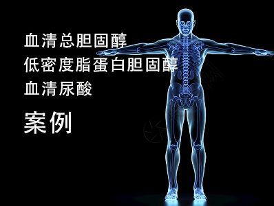 血清总胆固醇/低密度脂蛋白胆固醇/血清尿酸测定 5 