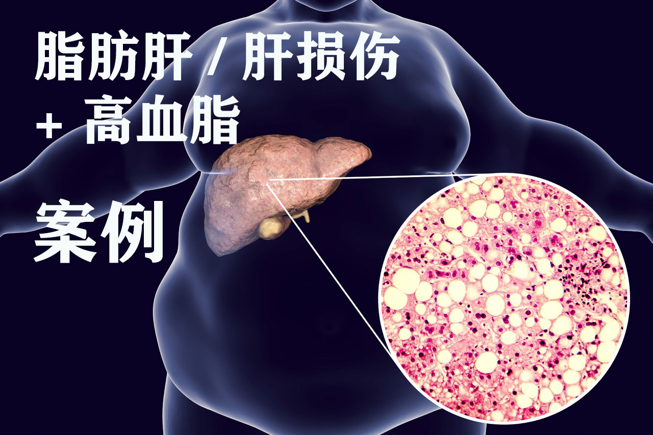 案例封面 2